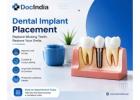 Find Best Doctors for Dental Implant Placement in Bangalore | DocIndia