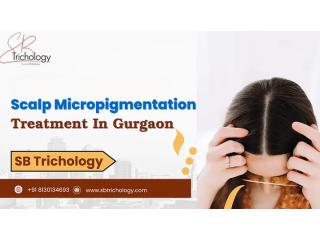 Best Clinic For Scalp Micropigmentation in Gurgaon - SB Trichology