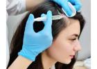 PRP Treatment in Delhi for Hair and Skin Rejuvenation