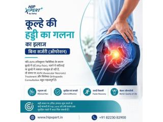 कूल्हे की हड्डी का गलना का इलाज बिना सर्जरी (ऑपरेशन)