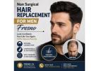 Non Surgical Hair Replacement For Men fresno