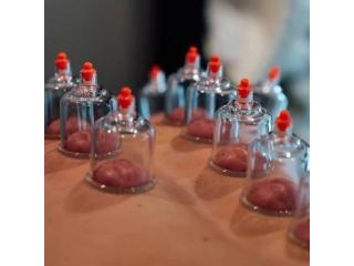 Best Cupping Therapy Services in Gurgaon | Pain Relief & Recovery