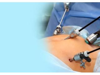 Best Laparoscopic Surgeon in Kolkata for Minimally Invasive Surgery