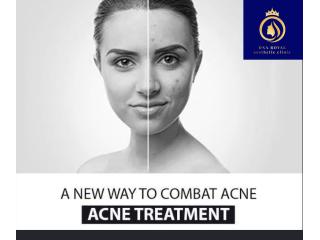 DNA Royal | Effective & Affordable Best Acne Treatment in Thane.