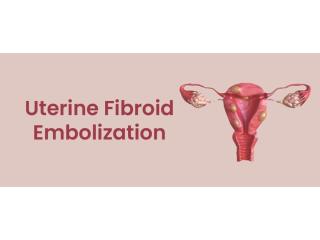 UFE Treatment for Uterine Fibroids | Minimally Invasive Care