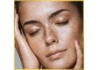 Nose Job Surgery in Los Angeles
