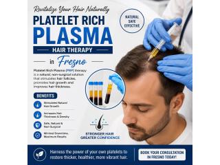 Platelet Rich Plasma Hair Therapy in Fresno