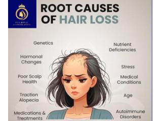 Advanced Hair Loss Treatment in Thane | DNA Royal Clinic.
