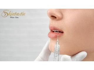 Lip Fillers Riverside for Safe and Natural Lip Volume