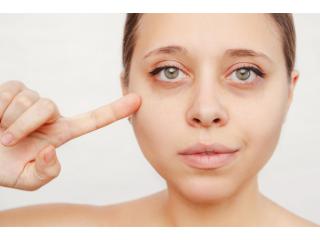 Advanced Dark Circle & Under-Eye Bag Treatment in Delhi