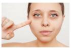 Advanced Dark Circle & Under-Eye Bag Treatment in Delhi