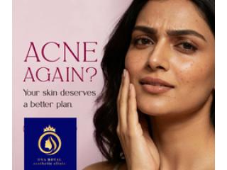 Premium Anti Ageing Facials in Thane | DNA Royal Skin Clinic,