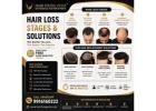 Dont Let Hair Loss Define You