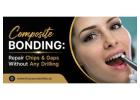 Composite Bonding: Repair Chips and Gaps Without Any Drilling