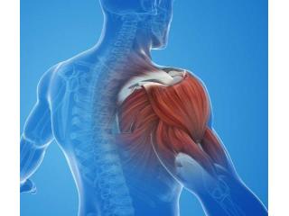 Shoulder Impingement in Gurgaon | Expert Physiotherapy for Lasting Shoulder Pain Relief