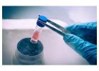 Fertility Preservation in Delhi - Dr Rhythm Gupta