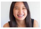 Orthodontic Care for Kids & Teens | Smile Squad