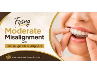 Fixing Moderate Misalignment with In****lign Clear Aligners