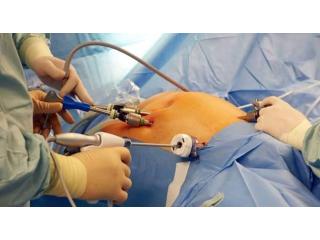 Expert Gall Stone Surgeon in Kolkata – Dr. Purnendu Roy