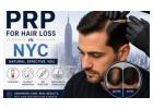 Why Choose Platelet-Rich Plasma Treatment for Hair Loss Alopecia in NYC?