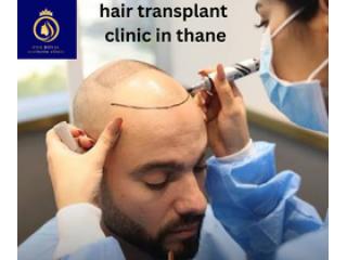 Best Hair Transplant Clinic in Thane | DNA Royal Hair Restoration.