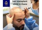 Best Hair Transplant Clinic in Thane | DNA Royal Hair Restoration.