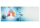 Lung Cancer Treatment in Delhi