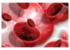 Hematology Treatment in Ahmedabad