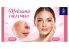 Trusted Clinic for the Best Melasma Treatment in Thane | DNA Royal.