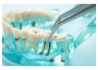 Expert Surgical Tooth Extraction | Rosedale Smiles