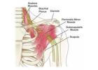 Brachial Plexus Injury Treatment in Gurgaon | Expert Physiotherapy & Nerve Rehabilitation