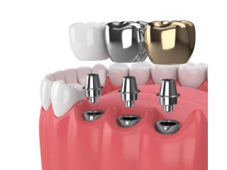 Best Dental Clinic Near Me