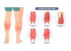 Calf Strain Treatment in Gurgaon | Expert Physiotherapy for Fast Recovery