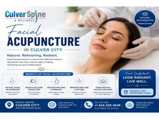 Best Facial Acupuncture Service in Culver City