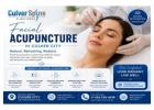 Best Facial Acupuncture Service in Culver City