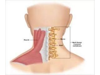 Cervical Spondylosis Treatment in Gurgaon | Expert Neck Pain & Spine Physiotherapy