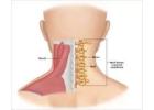 Cervical Spondylosis Treatment in Gurgaon | Expert Neck Pain & Spine Physiotherapy