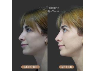 Explore a Consultation-Led Approach to Nasal Profiling