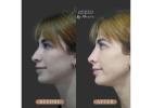 Explore a Consultation-Led Approach to Nasal Profiling