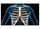 Costochondritis Physiotherapy Treatment in Gurgaon | Expert Physiotherapy for Chest Wall Pain Relief