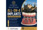 What Is the Cost of All-on-4 Implants in Rochester, Kent?