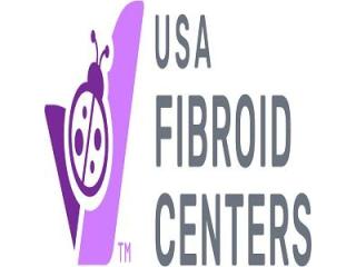 Don't Ignore These Early Signs of Uterine Fibroids