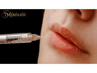 Lip Fillers Riverside for Fuller and Softer Lips