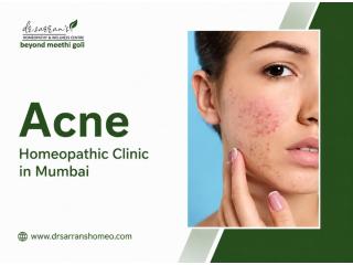 Safe Acne Homeopathy Treatment for Clear Skin and Confidence