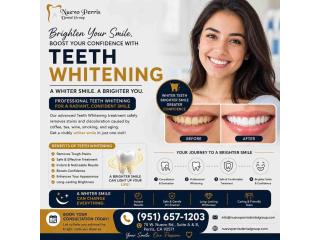 Teeth Whitening Treatment in Moreno Valley | Dr. Tejas Modi