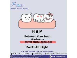 Perfect Smile Super Speciality Dental Clinic Kolkata - Best Dental Clinic in Kolkata