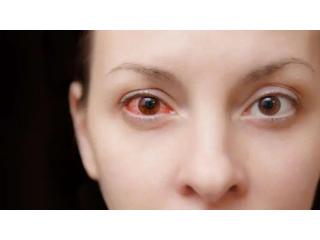 Better Eye Comfort With Dry Eye Treatment in Faridabad