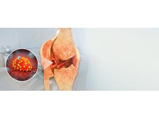 Bone Cancer Hospital in Delhi