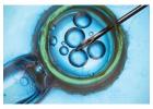 IVF Treatment Cost in Delhi - Dr Rhythm Gupta