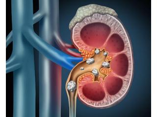 Top Nephrologist in Dehradun for Trusted Renal Healthcare
